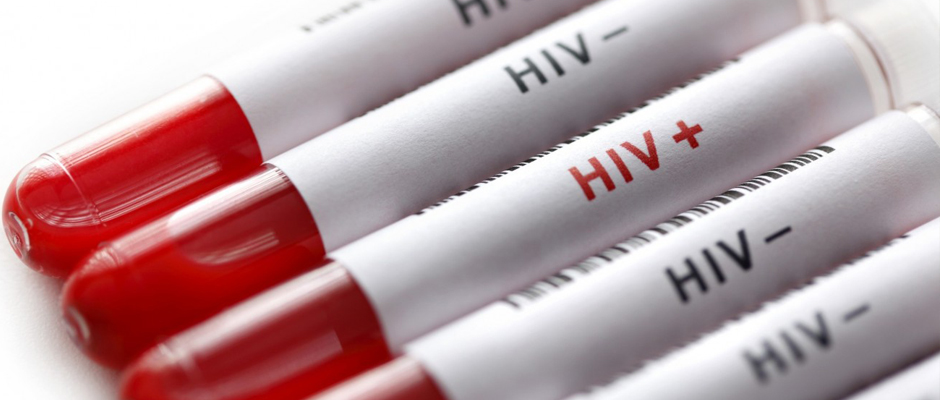 'HIV ahlaki değil, tıbbi bir durumdur’