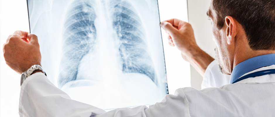 Akciğer kanserinde anahtar: doğru hastaya, doğru hedefle, doğru tedaviyi uygulamak
