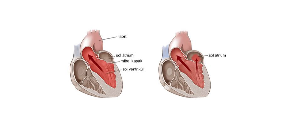 Kalbin içindeki mucize: Mitral kapak