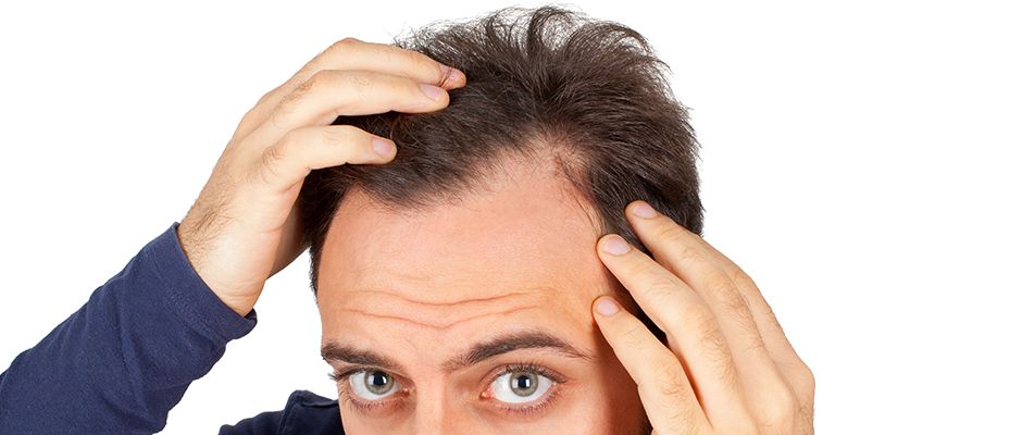 Erkeklerde genetik saç dökülmesi nasıl önlenir?