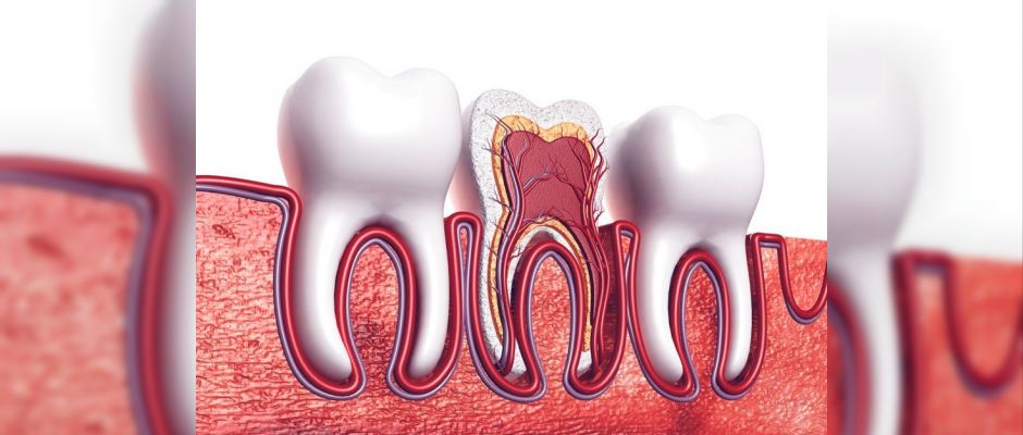 Kulağa vuran diş ağrısı pulpitis kaynaklı olabilir mi, kanal tedavisi nedir?