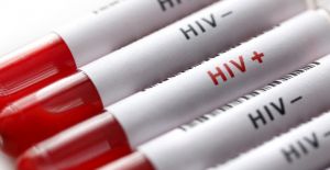 'HIV ahlaki değil, tıbbi bir durumdur’