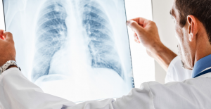 Akciğer kanserinde anahtar: doğru hastaya, doğru hedefle, doğru tedaviyi uygulamak