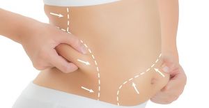 Liposuction Nedir? Yöntemleri Nelerdir?