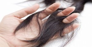 Saç Sağlığınıza Yenilik Getirin Ankara Saç Kök Hücre Hizmetleri