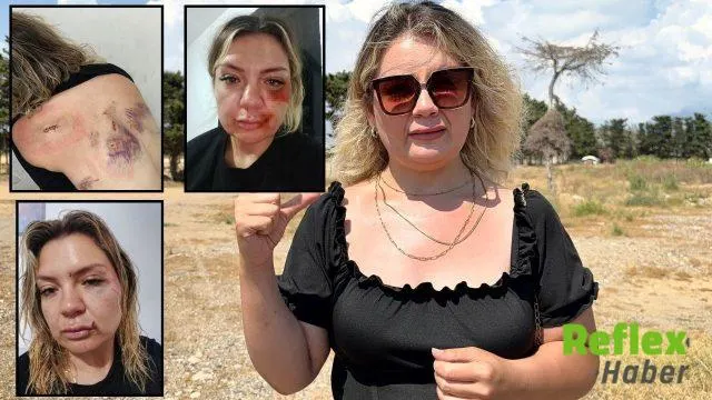 Özge Çelik Saldırısında O.k. Hakkında Dava Açıldı